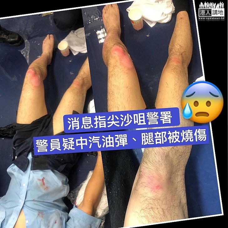 【燒傷警察】消息：有人向尖沙咀警察擲汽油彈，有警員腿部疑被燒傷。