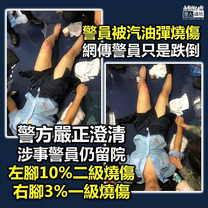 【澄清抹黑】警方澄清受汽油彈燒傷警員至今仍留院 反問造謠者居心何在