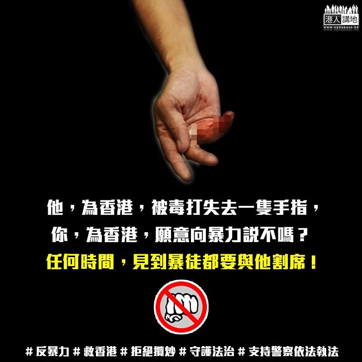 【二次創作】他，為香港，失去一隻手指，  你，為香港，願意向暴力說不嗎？