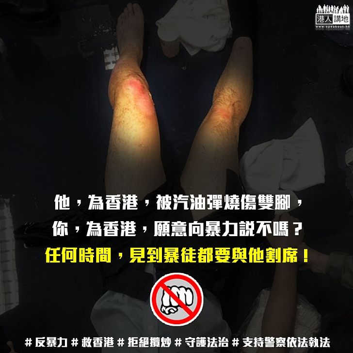 【二次創作】他，為香港，被汽油彈燒傷雙腳，你，為香港，願意向暴力說不嗎？
