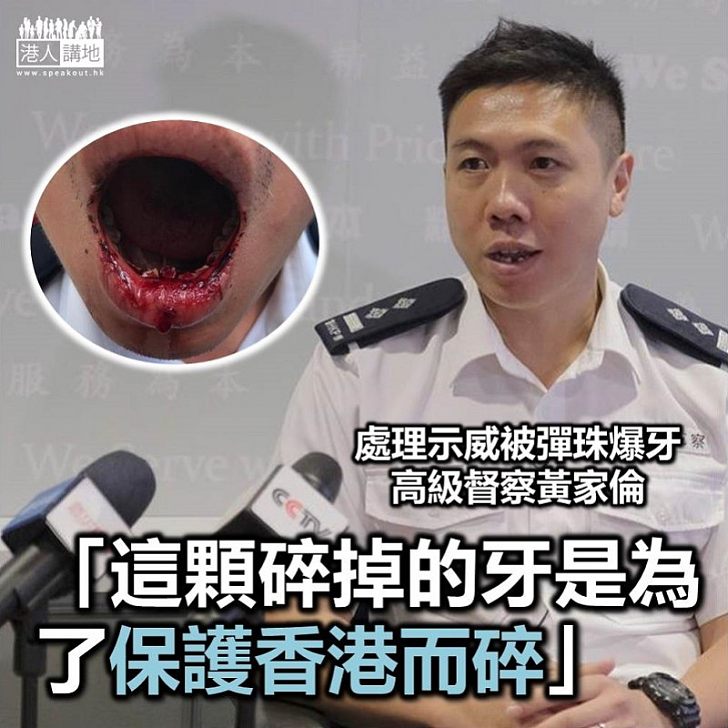 【為了香港】高級督察黃家倫：這顆碎掉的牙是為了保護香港而碎