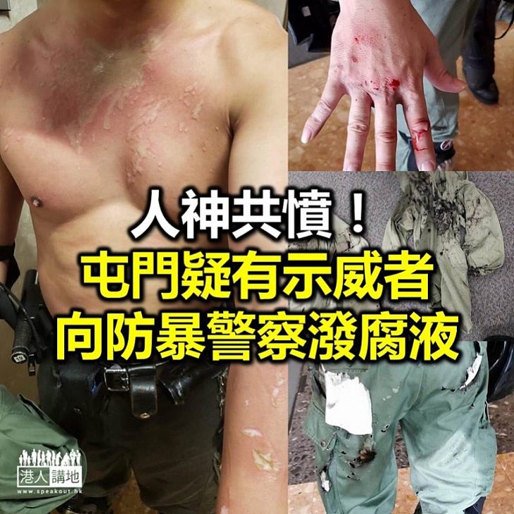 【屯門之亂】屯門狂徒向警察擲腐液彈