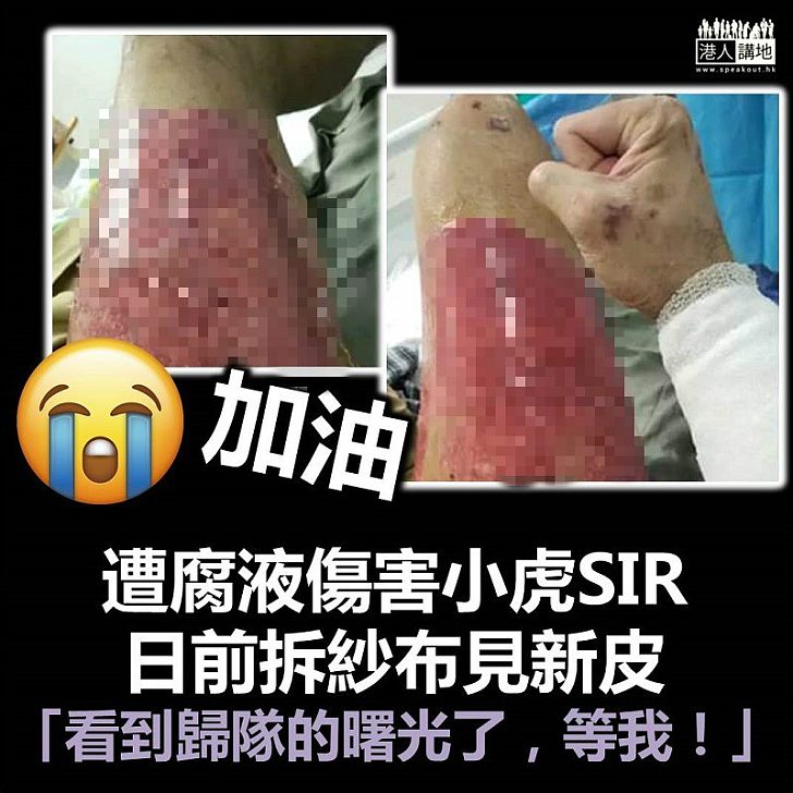 【早日康復】被腐液弄傷小虎SIR：看到歸隊的曙光了，等我！