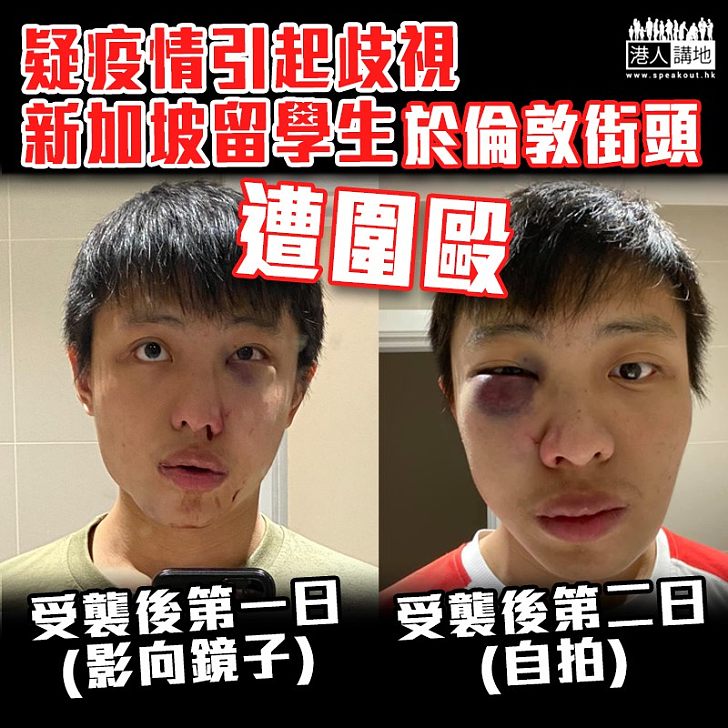 【新冠肺炎】疑疫情引起歧視 新加坡留學生倫敦街頭遭圍毆