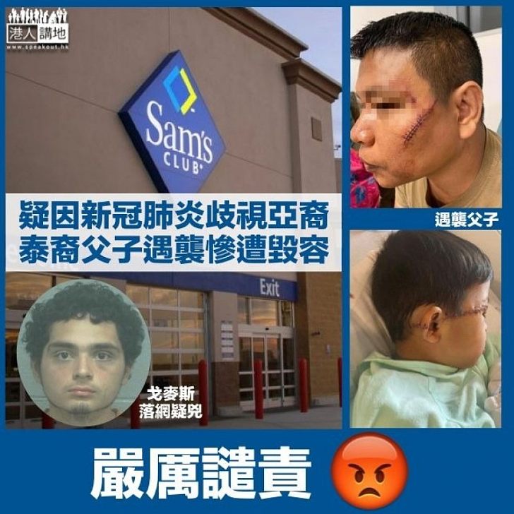 【新冠肺炎】疑因疫情歧視亞裔 美國19歲青年超市襲四人、泰裔父子慘遭毁容