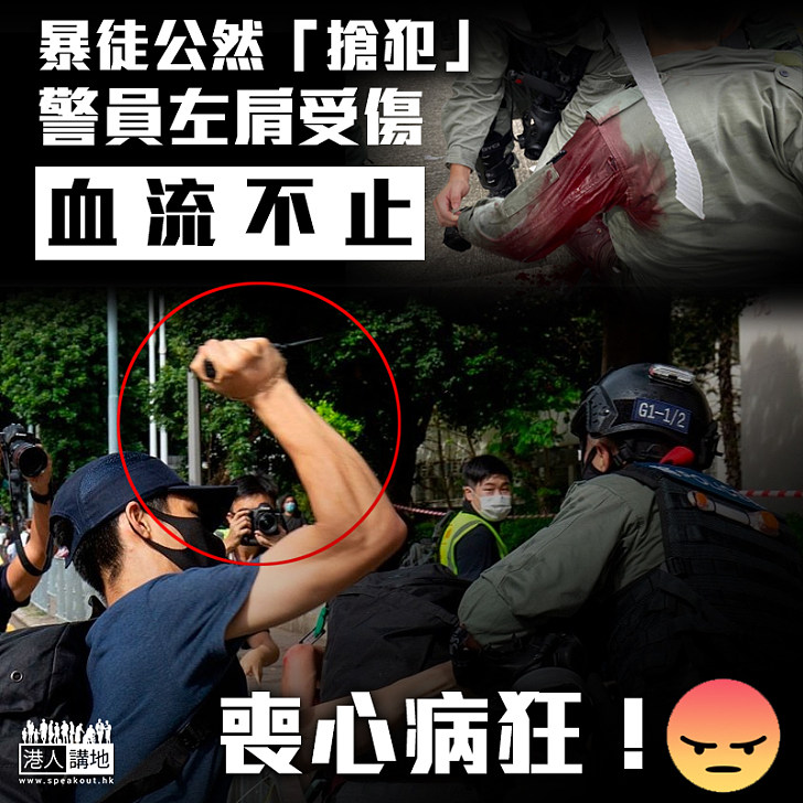 【喪心病狂】暴徒公然襲警搶犯 警員左肩受傷浴血