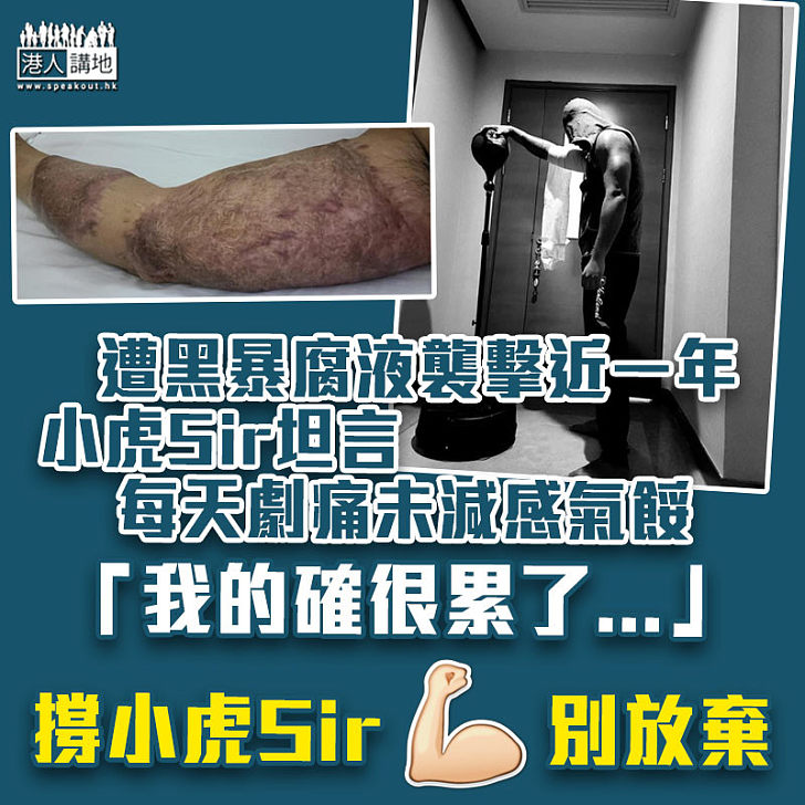 【齊齊撐警】遭暴徒以腐液襲擊近一年 小虎Sir坦言每天劇痛未減感氣餒