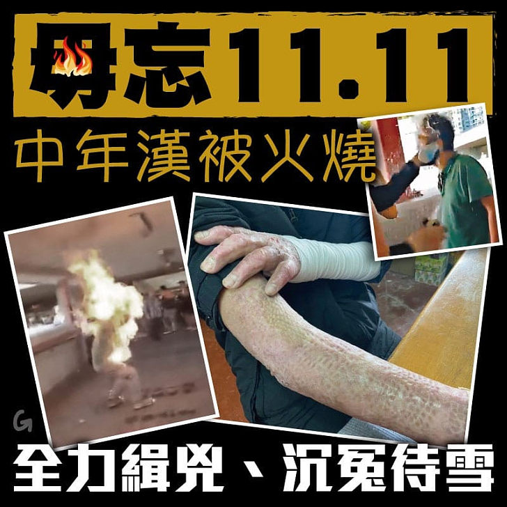 【今日網圖】毋忘11.11 中年漢被火燒 