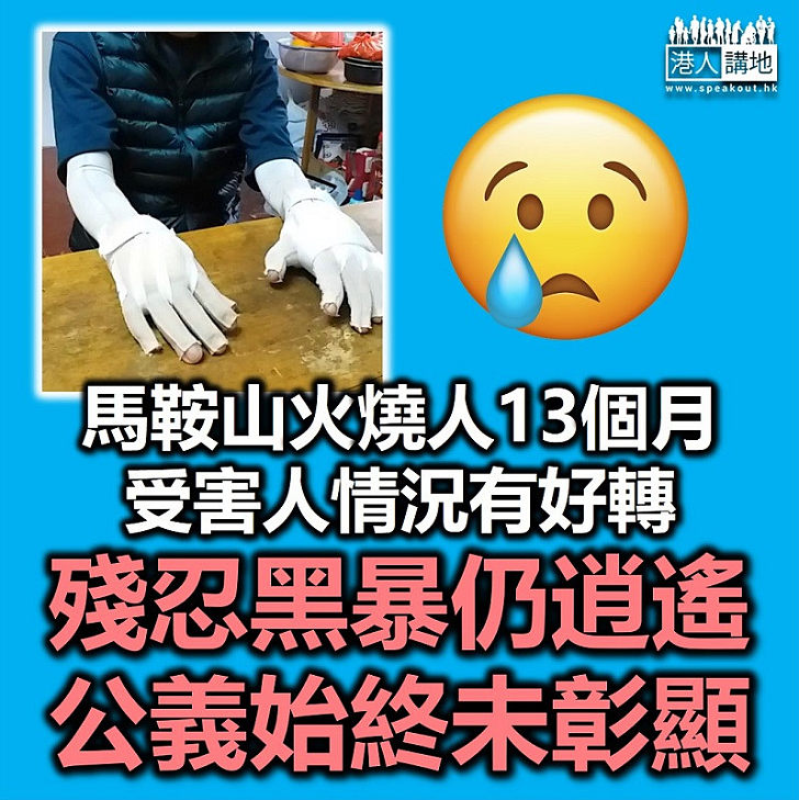 【黑暴運動】馬鞍山被燒受害人和旺角被群毆內地青年情況轉好