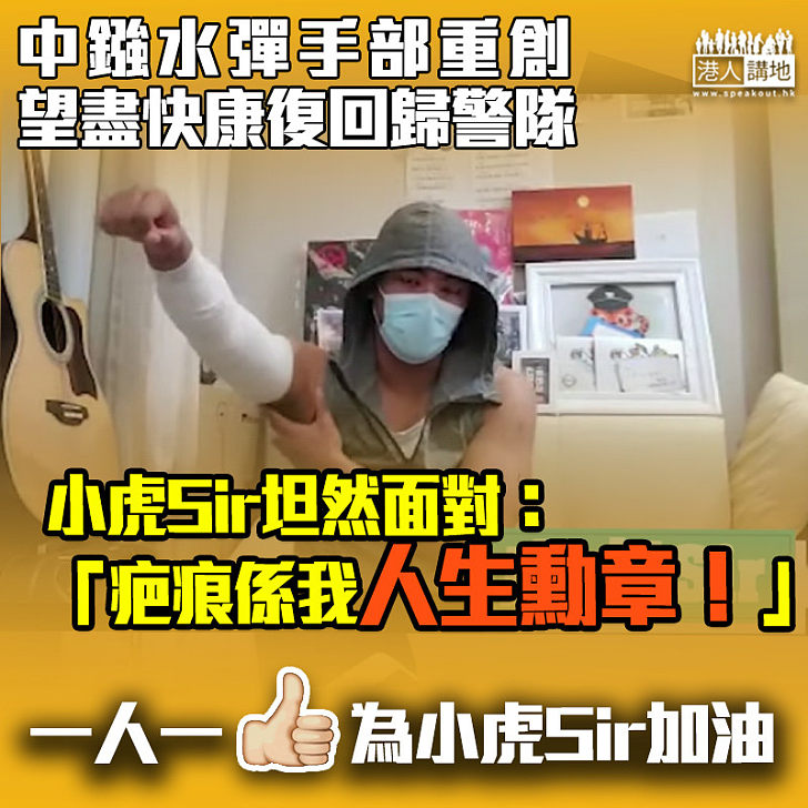 【堅毅不屈】小虎Sir：疤痕是我人生一個勳章、望盡快康復回歸警隊！