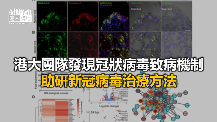 【焦點新聞】港大團隊揭細胞凋亡為冠狀病毒重要致病機制