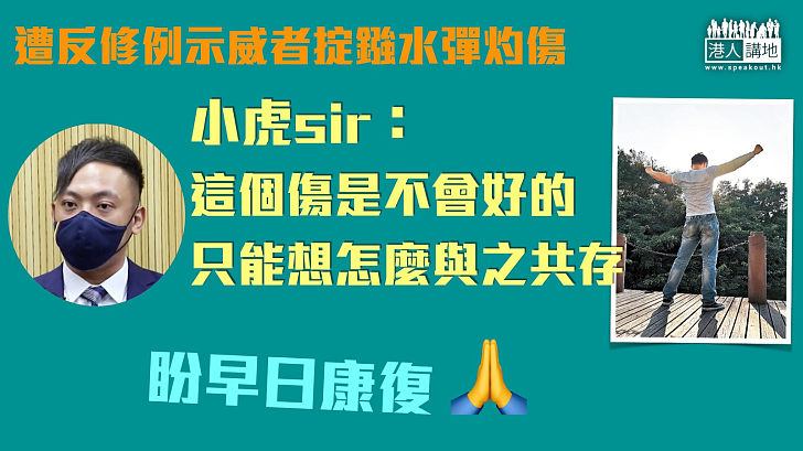 【勇敢面對】遭反修例示威者掟鏹水彈灼傷 小虎Sir：這個傷是不會好的、只能想怎麼與之共存