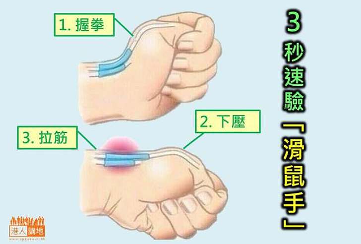 3秒鑑定 你有無滑鼠手？