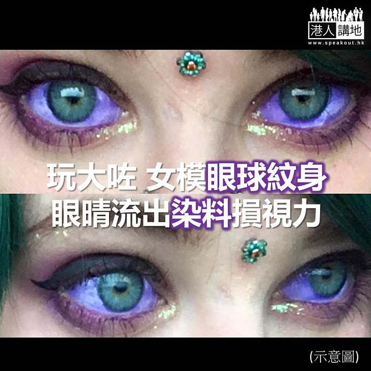 【焦點新聞】無眼睇！女模眼球紋身流紫色染料損視力 (2)